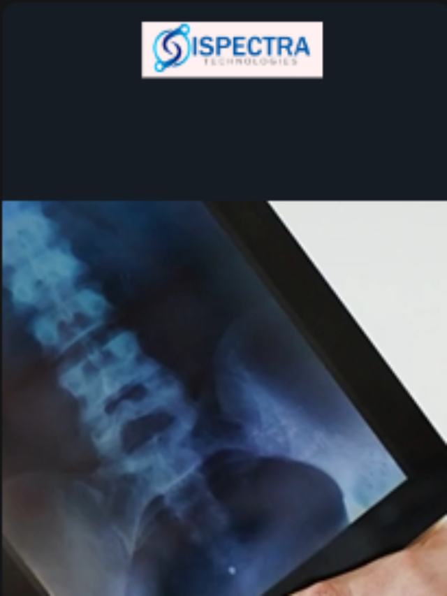 Empowering Healthcare with Automation: Ispectra’s Approach to Smarter Operations and Better Patient Care
